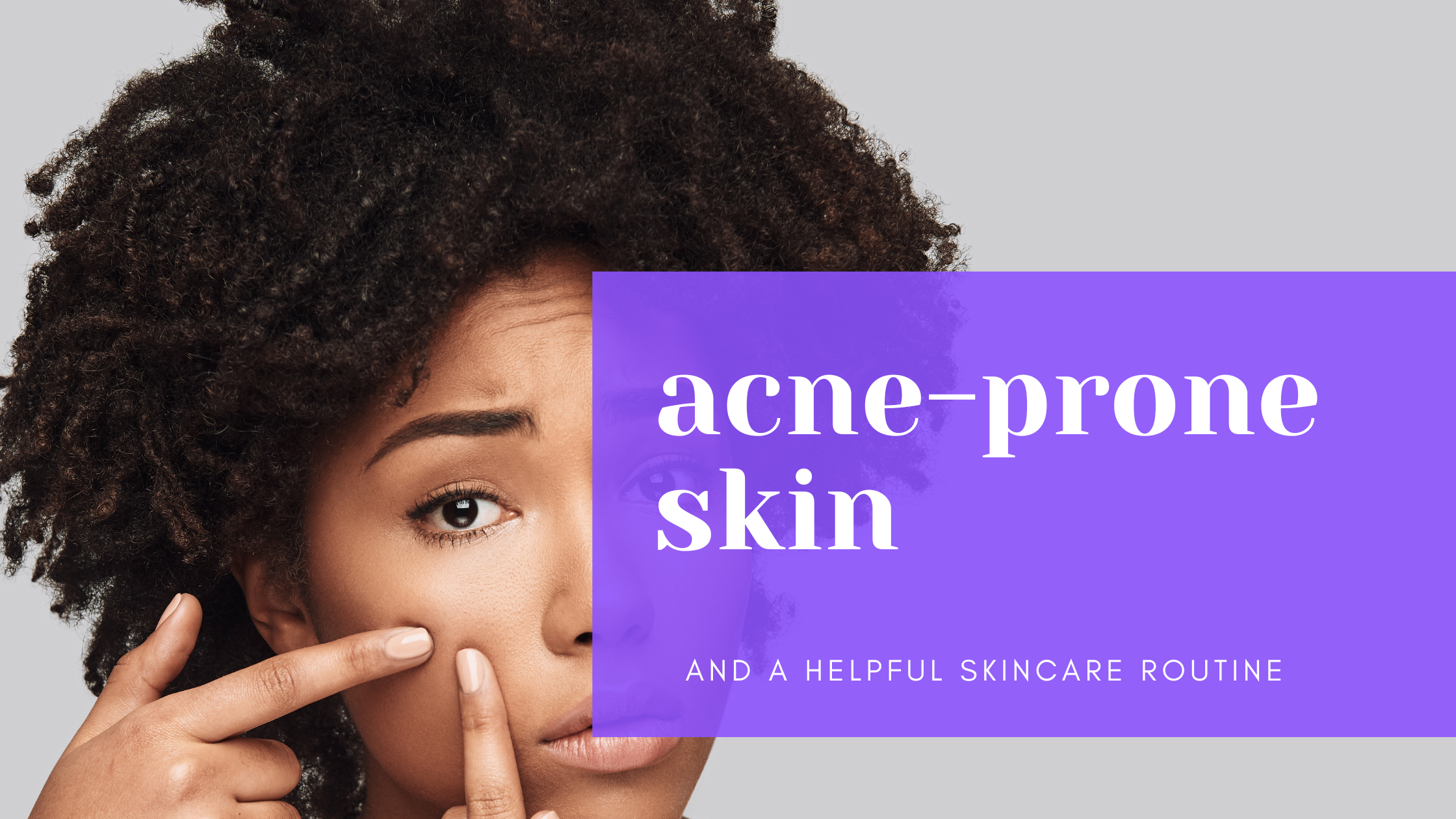 What is Acne-prone Skin?